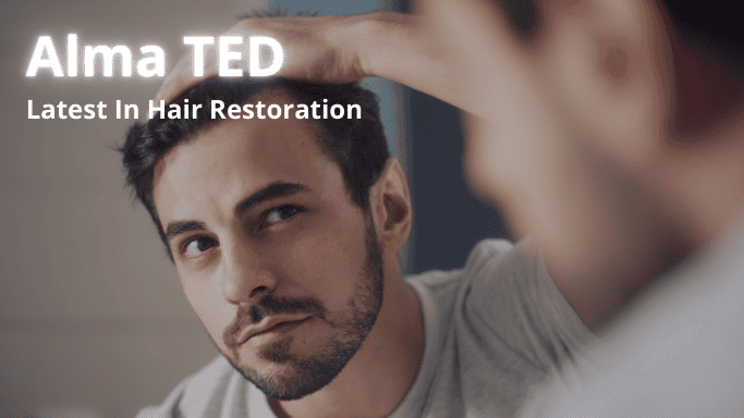 Alma TED treatment in Kitchener Waterloo Cambridge area