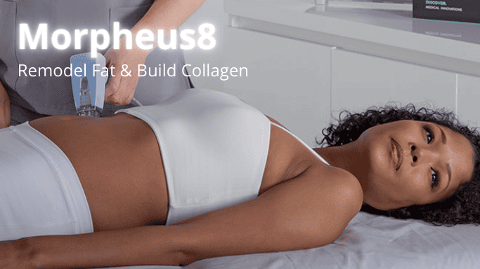 Morpheus8 body treatment in Kitchener Waterloo Cambridge area