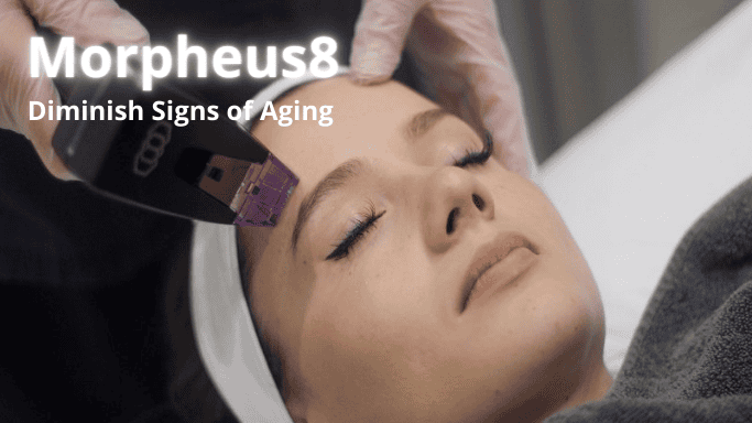 Morpheus8 treatment in Kitchener Waterloo Cambridge area