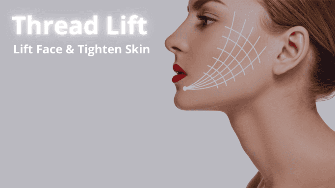 Thread lift in Mississauga area