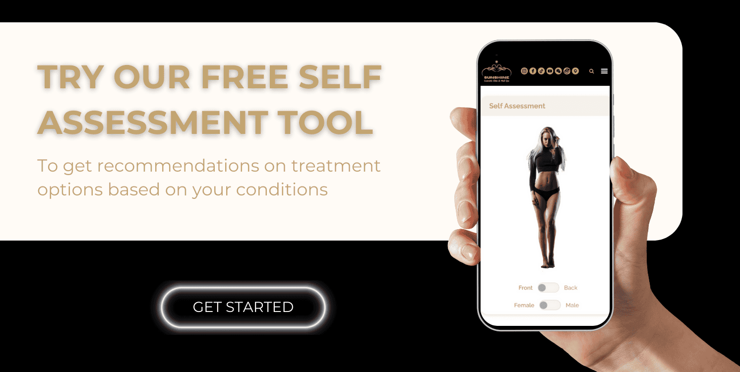 try out self assessment tool for your skin concerns in Mississauga area