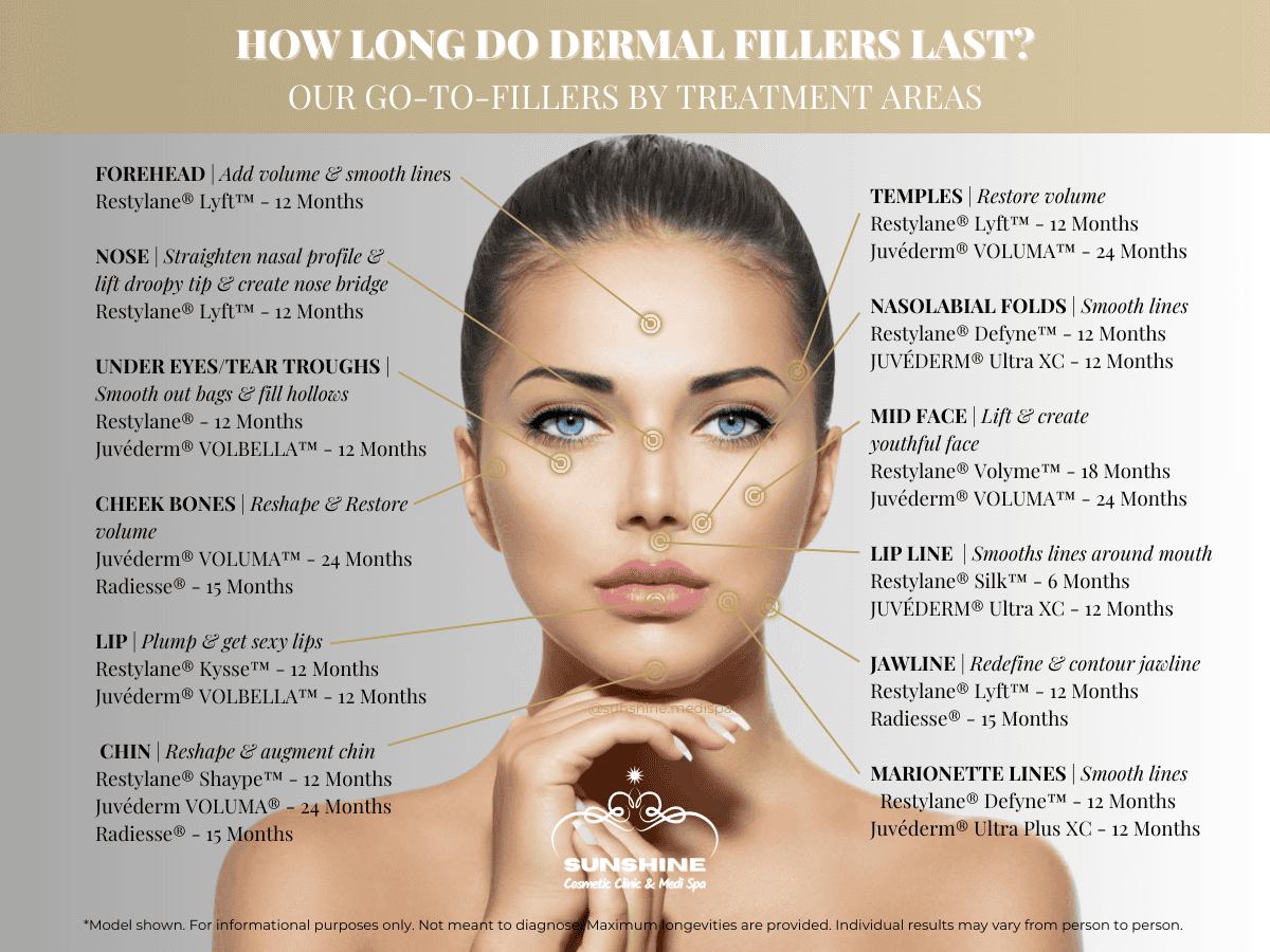 Typical time last for our go-to dermal fillers of different treatment areas