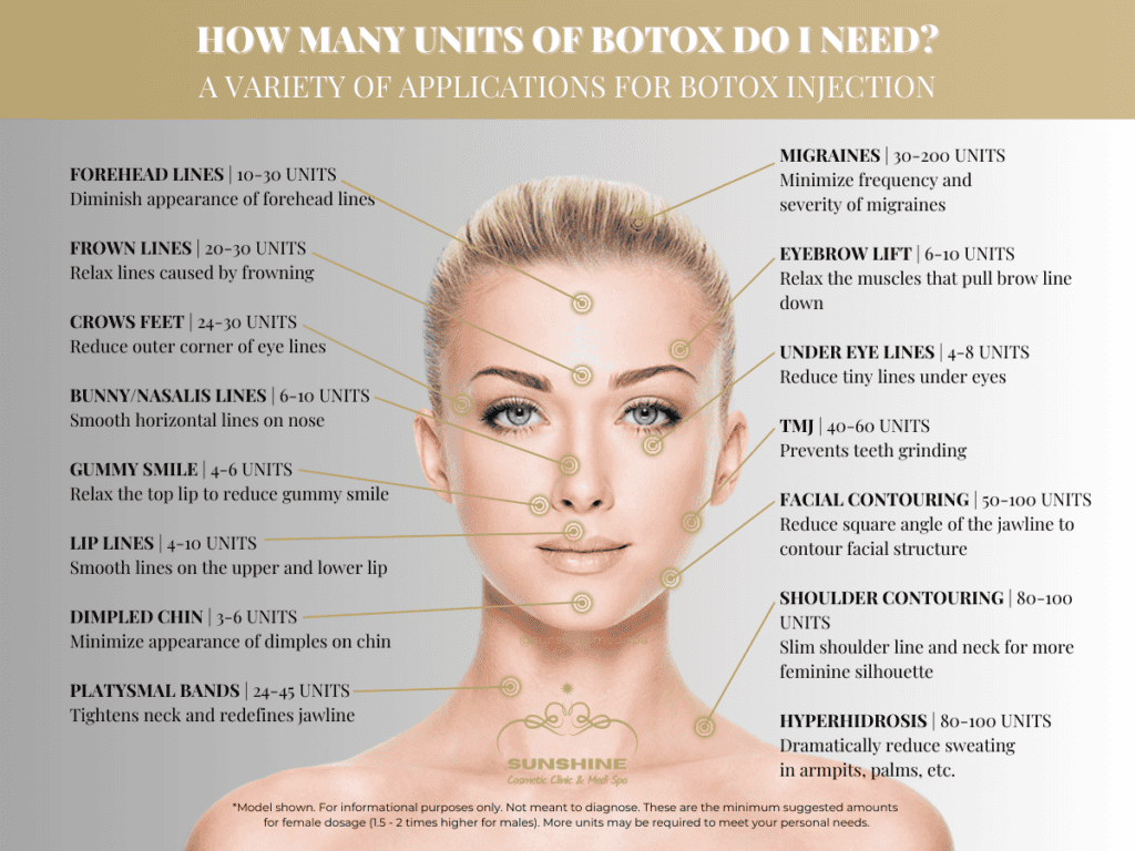 Recommended Botox injection dosage for our clients in Mississauga area.