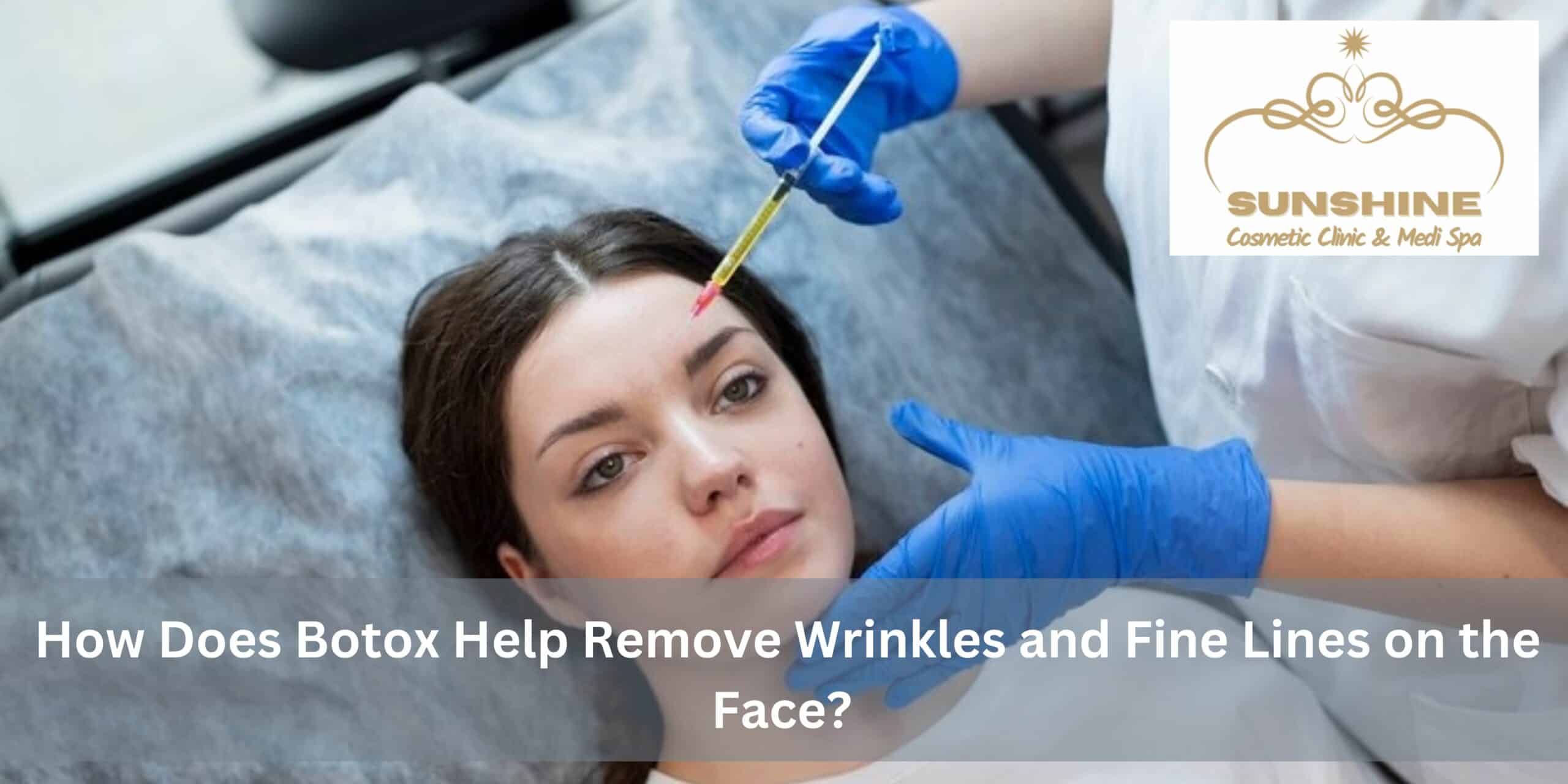 How Does Botox Help Remove Wrinkles and Fine Lines on the Face?