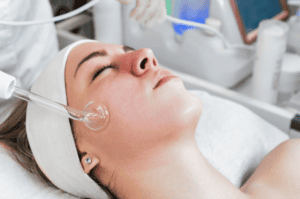 Advice for Long-Term Outcomes in Acne Treatment and Prevention | Waterloo, ON | Sunshine Cosmetic Clinic & Medi Spa