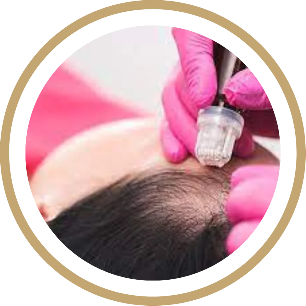 Hair Restoration Test