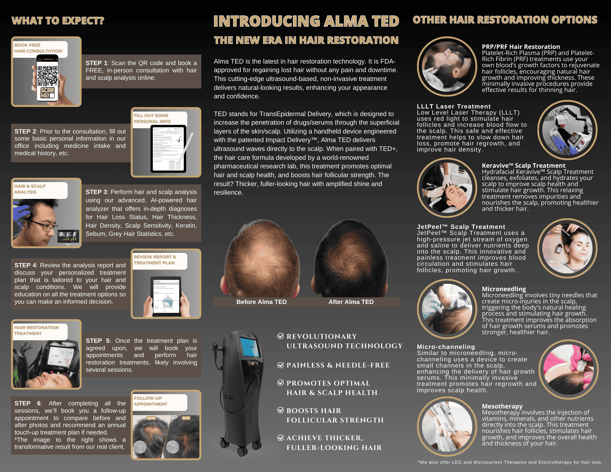 Brochure - Hair Restoration -Sunshine Cosmetic Clinic and Medi Spa - back