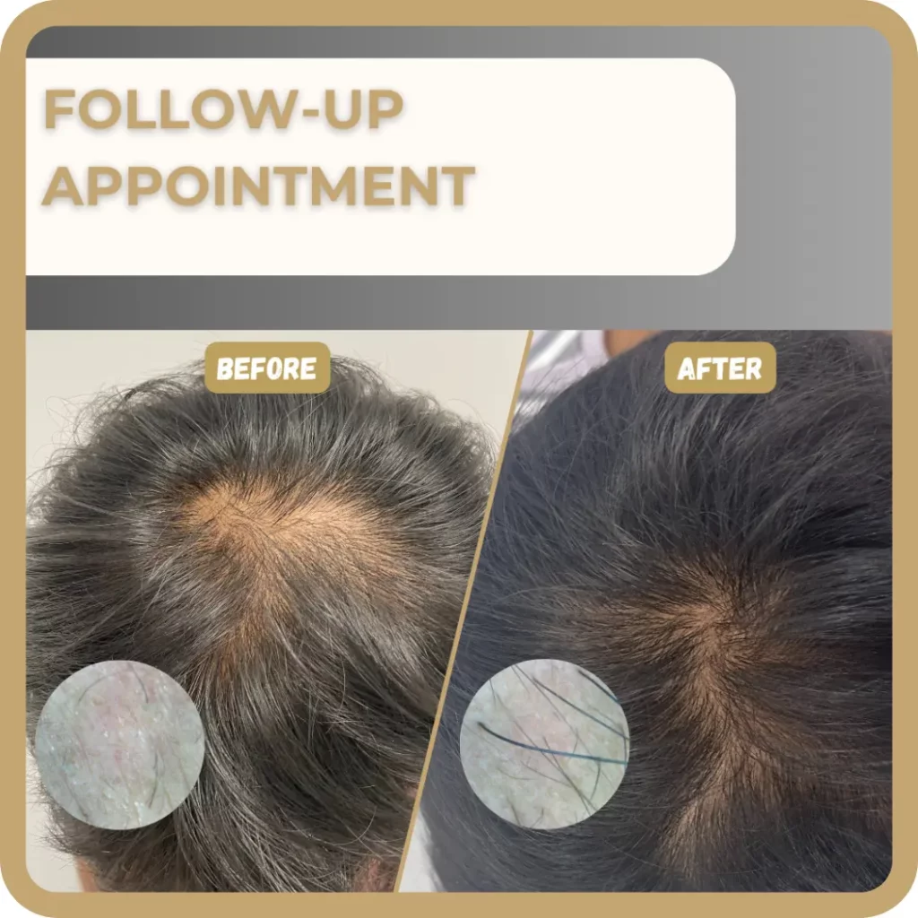 Hair Restoration Test