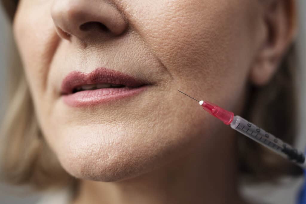 Correct and Perfect: Dermal Fillers in Waterloo for Scars, Wrinkles, and Volume Loss | Waterloo, ON | Sunshine Cosmetic Clinic & Medi Spa