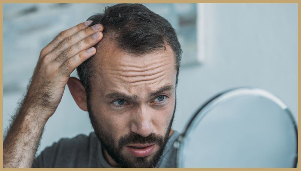 male Pattern Hair-Loss in mississauga ontario