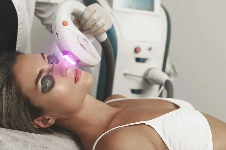 Top 5 Benefits of IPL for Skin Rejuvenation
