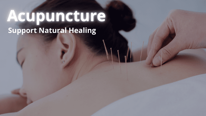 We offer acupuncture in waterloo kitchener cambridge ontario as one of our wellness treatments